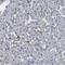 C-Type Lectin Domain Family 4 Member G antibody, NBP1-82815, Novus Biologicals, Immunohistochemistry frozen image 