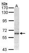 Interferon Alpha And Beta Receptor Subunit 1 antibody, PA5-21462, Invitrogen Antibodies, Western Blot image 