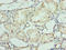 DExH-Box Helicase 9 antibody, LS-C371317, Lifespan Biosciences, Immunohistochemistry paraffin image 