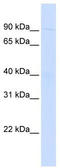 WD Repeat And FYVE Domain Containing 3 antibody, TA339825, Origene, Western Blot image 
