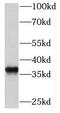 Mitochondrial Trans-2-Enoyl-CoA Reductase antibody, FNab05083, FineTest, Western Blot image 