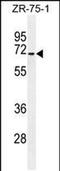 HAUS Augmin Like Complex Subunit 3 antibody, PA5-48166, Invitrogen Antibodies, Western Blot image 