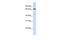 Long-chain-fatty-acid--CoA ligase 5 antibody, PA5-42999, Invitrogen Antibodies, Western Blot image 