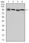 Eukaryotic Translation Elongation Factor 2 antibody, NBP2-37620, Novus Biologicals, Western Blot image 