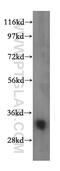 VAMP Associated Protein A antibody, 15275-1-AP, Proteintech Group, Western Blot image 