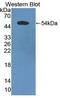 Programmed Cell Death 6 Interacting Protein antibody, LS-C723367, Lifespan Biosciences, Western Blot image 