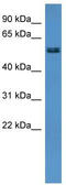 ALG8 Alpha-1,3-Glucosyltransferase antibody, TA335475, Origene, Western Blot image 