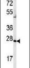 Adenylate Kinase 2 antibody, PA5-15429, Invitrogen Antibodies, Western Blot image 