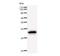 Scm Polycomb Group Protein Like 2 antibody, LS-C342320, Lifespan Biosciences, Western Blot image 