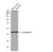 Interleukin 1 Receptor Type 2 antibody, NBP1-32681, Novus Biologicals, Western Blot image 