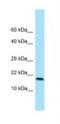 Cripto, FRL-1, Cryptic Family 1 antibody, NBP1-98527, Novus Biologicals, Western Blot image 