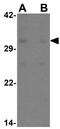 Paired Like Homeobox 2A antibody, GTX17170, GeneTex, Western Blot image 