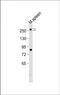 Mediator Complex Subunit 12 antibody, PA5-72243, Invitrogen Antibodies, Western Blot image 