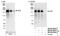 Insulin Receptor Substrate 2 antibody, NB100-68242, Novus Biologicals, Western Blot image 