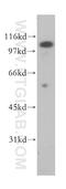 Folate Hydrolase 1 antibody, 13163-1-AP, Proteintech Group, Western Blot image 