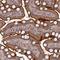 Transmembrane Channel Like 5 antibody, HPA040810, Atlas Antibodies, Immunohistochemistry paraffin image 