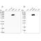 Insulin Like Growth Factor Binding Protein Acid Labile Subunit antibody, PA5-59367, Invitrogen Antibodies, Western Blot image 