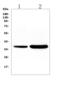 Troponin T3, Fast Skeletal Type antibody, A05885-2, Boster Biological Technology, Western Blot image 