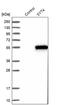 Synaptotagmin 4 antibody, PA5-52709, Invitrogen Antibodies, Western Blot image 