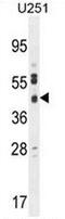 Solute Carrier Family 35 Member F6 antibody, AP50737PU-N, Origene, Western Blot image 