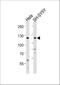 Receptor Tyrosine Kinase Like Orphan Receptor 2 antibody, A01840-1, Boster Biological Technology, Western Blot image 