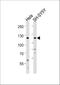 mROR2 antibody, A01840-1, Boster Biological Technology, Western Blot image 