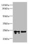 Transmembrane P24 Trafficking Protein 2 antibody, A61346-100, Epigentek, Western Blot image 