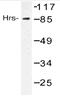 Hepatocyte Growth Factor-Regulated Tyrosine Kinase Substrate antibody, AP20509PU-N, Origene, Western Blot image 