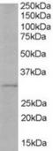 TIR Domain Containing Adaptor Protein antibody, TA302730, Origene, Western Blot image 