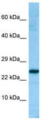Peroxiredoxin 4 antibody, TA338131, Origene, Western Blot image 