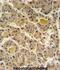 INO80 Complex Subunit D antibody, abx032390, Abbexa, Immunohistochemistry paraffin image 