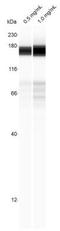 Histone Deacetylase 6 antibody, NBP2-67891, Novus Biologicals, Western Blot image 