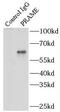 Melanoma antigen preferentially expressed in tumors antibody, FNab06746, FineTest, Immunoprecipitation image 