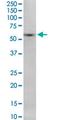 Sorting Nexin 8 antibody, MA5-24455, Invitrogen Antibodies, Western Blot image 