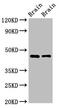 SRY-Box 11 antibody, CSB-PA022419LA01HU, Cusabio, Western Blot image 