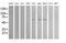 Aldehyde Dehydrogenase 1 Family Member A3 antibody, MA5-25528, Invitrogen Antibodies, Western Blot image 