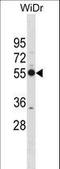 Proteasome 26S Subunit, Non-ATPase 12 antibody, LS-C155864, Lifespan Biosciences, Western Blot image 