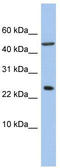 Ankyrin Repeat Domain 7 antibody, TA335504, Origene, Western Blot image 