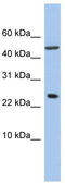 Ankyrin Repeat Domain 7 antibody, TA335504, Origene, Western Blot image 