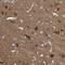 TNFRSF21 antibody, NBP1-84982, Novus Biologicals, Immunohistochemistry frozen image 