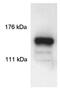 SIN3 Transcription Regulator Family Member A antibody, GTX23479, GeneTex, Western Blot image 