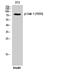 GRB2 Associated Binding Protein 1 antibody, A01989Y659, Boster Biological Technology, Western Blot image 