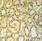 Mitochondrial Ribosomal Protein S25 antibody, LS-C162790, Lifespan Biosciences, Immunohistochemistry paraffin image 