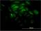 Synaptotagmin 11 antibody, H00023208-M03, Novus Biologicals, Immunocytochemistry image 