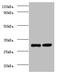 Ubiquinol-Cytochrome C Reductase Complex III Subunit VII antibody, A51565-100, Epigentek, Western Blot image 