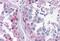 Cytochrome P450 Family 26 Subfamily B Member 1 antibody, NB100-53810, Novus Biologicals, Immunohistochemistry paraffin image 