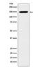 Chromatin Assembly Factor 1 Subunit A antibody, M02732-1, Boster Biological Technology, Western Blot image 