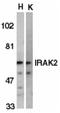Interleukin-1 receptor-associated kinase-like 2 antibody, LS-B3188, Lifespan Biosciences, Western Blot image 