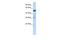 Scm Polycomb Group Protein Like 1 antibody, A12084, Boster Biological Technology, Western Blot image 