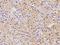 Ataxin 7 Like 2 antibody, 205103-T08, Sino Biological, Immunohistochemistry paraffin image 